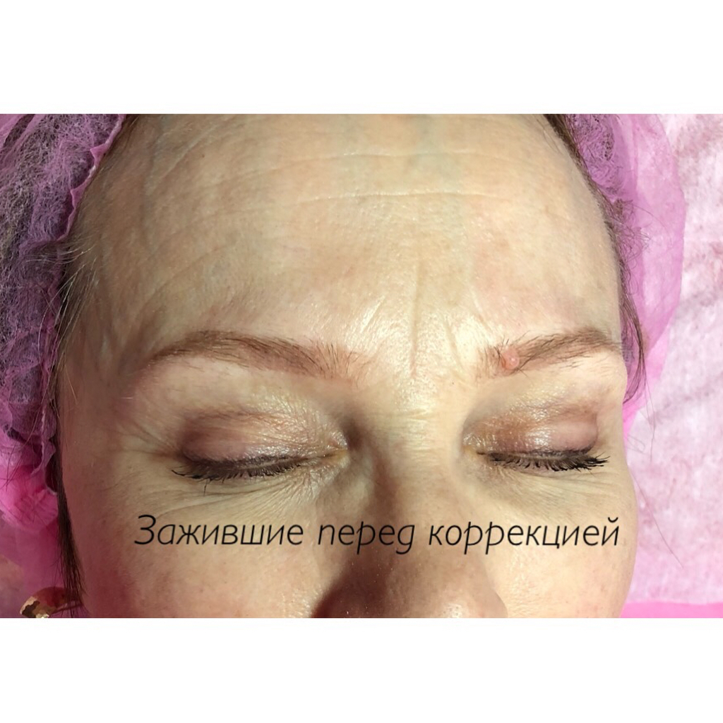 Пудровые брови на возрастной коже до и после коррекции с родинкой в Хабаровске