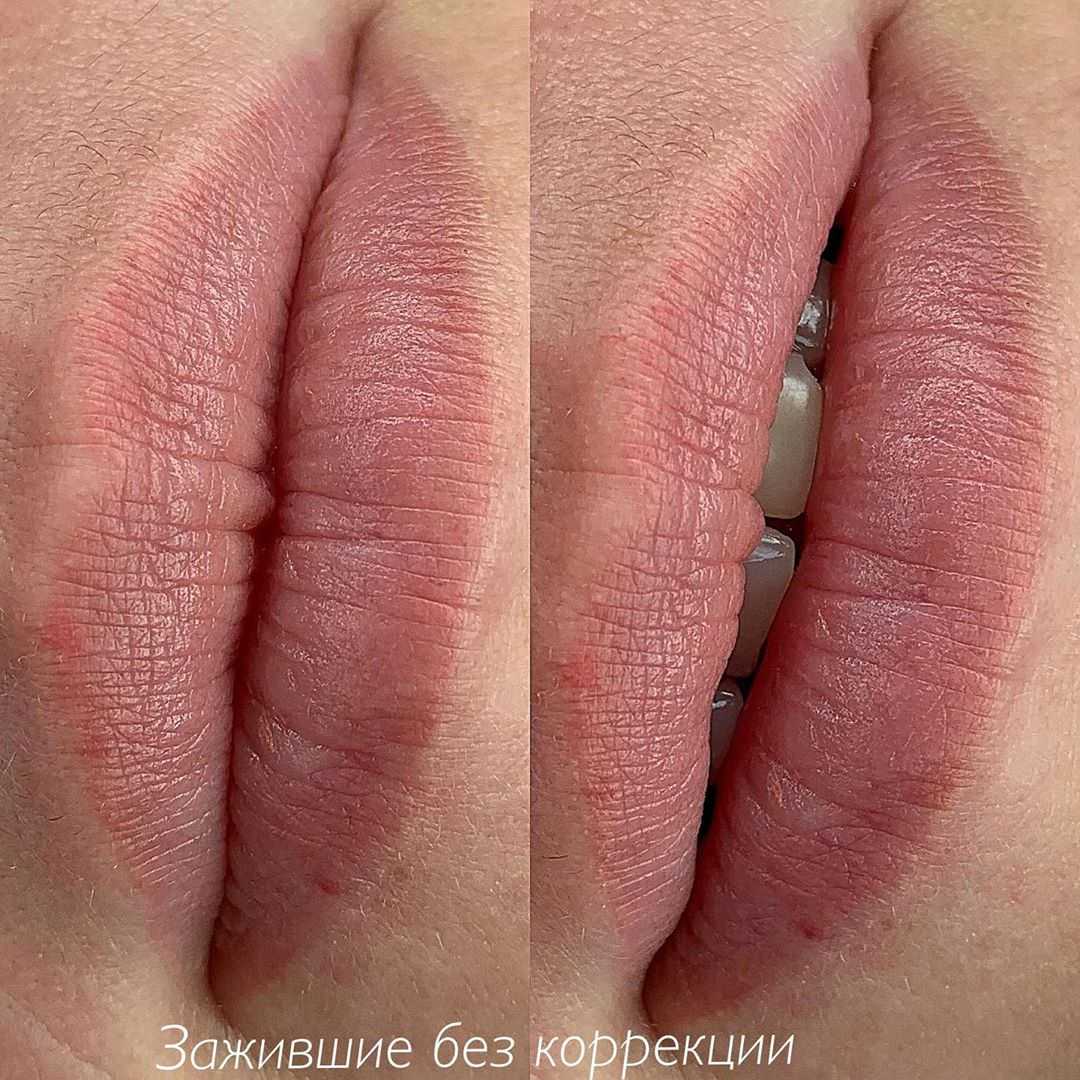 Заживший перманентный макияж губ|Хабаровск