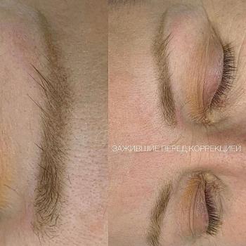 Заживший перманентный макияж бровей перед коррекцией | Редкие брови