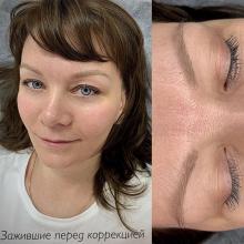 Заживший перманентный макияж бровей перед коррекцией | Работа со шрамами | Хабаровск