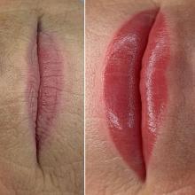 Нюдовые губы до и после процедуры