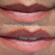 Перманентному макияжу губ полтора месяца | Хабаровск
