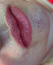 Перманентный макияж губ после процедуры