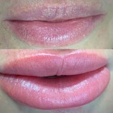 Обновление перманентного макияжа губ в Хабаровске | Фото и видео