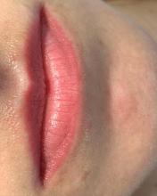 Заживший перманентный макияж губ перед коррекцией | Фото без фильтров