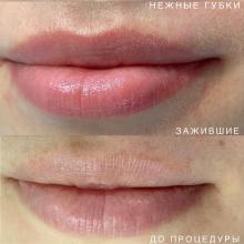 Перманентный макияж губ заживший в Хабаровске